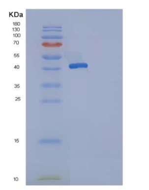 Recombinant Human Osteoprotegerin / TNFRSF11B Protein (His tag),Recombinant Human Osteoprotegerin / TNFRSF11B Protein (His tag)