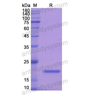 重组GPX1蛋白,Recombinant Human GPX1, N-His