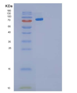 Recombinant Human Cadherin-3/CDH3 Protein(C-6His),Recombinant Human Cadherin-3/CDH3 Protein(C-6His)