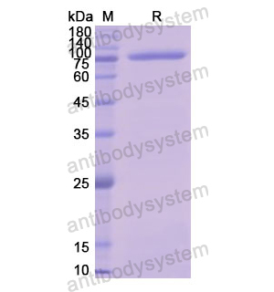 重组CD141/THBD蛋白,Recombinant Human CD141/THBD, N-GST