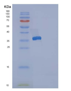 Recombinant Human Reticulocalbin 3 Protein (His Tag),Recombinant Human Reticulocalbin 3 Protein (His Tag)
