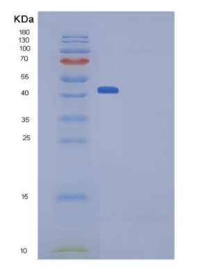 Recombinant Mouse Pleiotrophin / PTN / HB-GAM Protein (Fc tag),Recombinant Mouse Pleiotrophin / PTN / HB-GAM Protein (Fc tag)