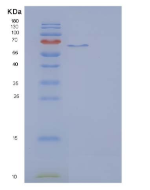 Recombinant Rat IL23R / IL23 Receptor Protein (Fc tag),Recombinant Rat IL23R / IL23 Receptor Protein (Fc tag)