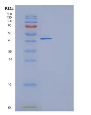 Recombinant Human TNFRSF19 / TROY Protein (Fc tag),Recombinant Human TNFRSF19 / TROY Protein (Fc tag)