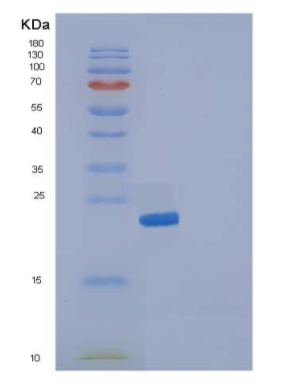 Recombinant Human IL19 / Interleukin-19 Protein (His tag),Recombinant Human IL19 / Interleukin-19 Protein (His tag)