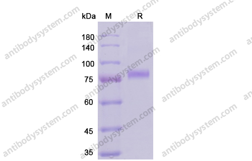 重组CD141/THBD蛋白,Recombinant Human CD141/THBD, C-His