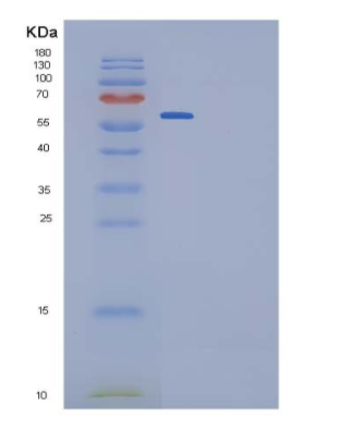 Recombinant Rat IL-6R / CD126 Protein (Fc tag, ECD),Recombinant Rat IL-6R / CD126 Protein (Fc tag, ECD)