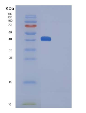 Recombinant Human CTLA4 / CD152 Protein (His & Fc tag),Recombinant Human CTLA4 / CD152 Protein (His & Fc tag)