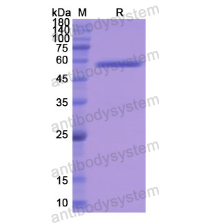 重组P4HB蛋白,Recombinant Human P4HB, N-GST