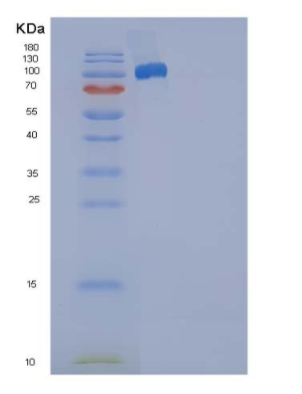 Recombinant Human SELP / selectin P / P-selectin Protein (Fc tag),Recombinant Human SELP / selectin P / P-selectin Protein (Fc tag)