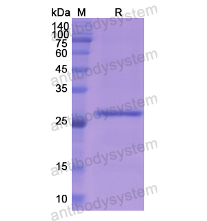 重组ASGR1蛋白,Recombinant Human ASGR1, N-His