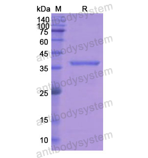 重组ASGR2蛋白,Recombinant Human ASGR2, N-His