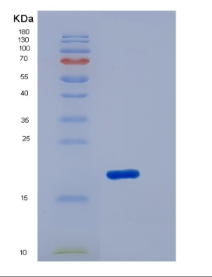 Recombinant Human IL18 / Interleukin 18 / IGIF Protein (GST tag),Recombinant Human IL18 / Interleukin 18 / IGIF Protein (GST tag)