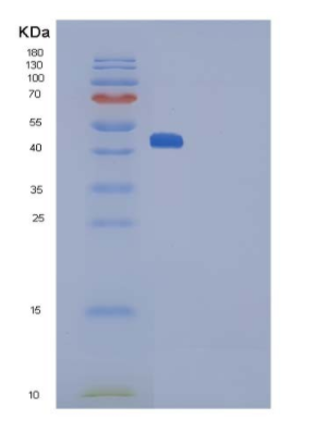 Recombinant Rat SerpinF1 / PEDF Protein (His Tag),Recombinant Rat SerpinF1 / PEDF Protein (His Tag)