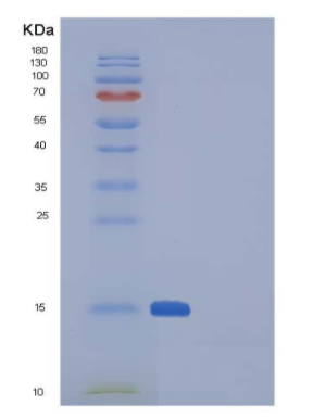 Recombinant Human SNCA / alpha-Synuclein Protein,Recombinant Human SNCA / alpha-Synuclein Protein