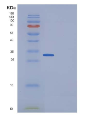 Recombinant Human DKK1 / Dkk-1 Protein (His tag),Recombinant Human DKK1 / Dkk-1 Protein (His tag)