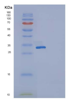 Recombinant Human Osteonectin / SPARC Protein (His tag),Recombinant Human Osteonectin / SPARC Protein (His tag)