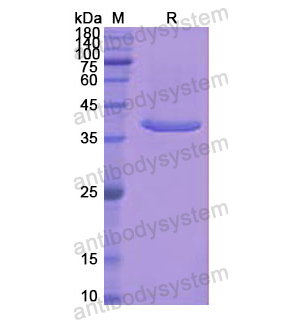 重組ACYP1蛋白,Recombinant Human ACYP1, N-GST