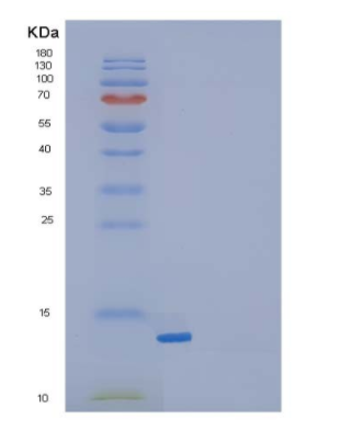 Recombinant Mouse Transforming Growth Factor β-1/TGFβ1/TGFB1 Protein,Recombinant Mouse Transforming Growth Factor β-1/TGFβ1/TGFB1 Protein