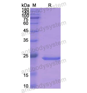 重组ADH1A蛋白,Recombinant Human ADH1A, N-His