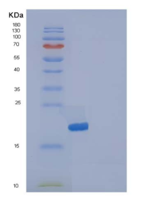 Recombinant Human IL1F5 / IL36RN Protein,Recombinant Human IL1F5 / IL36RN Protein