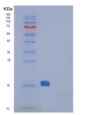 Recombinant Mouse CTLA4 / CD152 Protein (His tag),Recombinant Mouse CTLA4 / CD152 Protein (His tag)