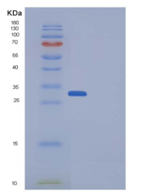 Recombinant Aequorea victoria GFP Protein (His Tag),Recombinant Aequorea victoria GFP Protein (His Tag)