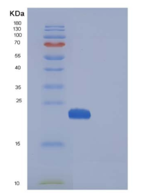 Recombinant Human MANF / ARMET Protein (His tag),Recombinant Human MANF / ARMET Protein (His tag)