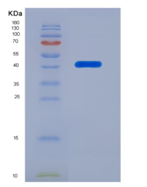 Eukaryotic B-Cell Activating Factor (BAFF),Eukaryotic B-Cell Activating Factor (BAFF)