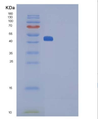 Recombinant Rat Interleukin 25 / IL25 / IL17E Protein (Fc tag),Recombinant Rat Interleukin 25 / IL25 / IL17E Protein (Fc tag)