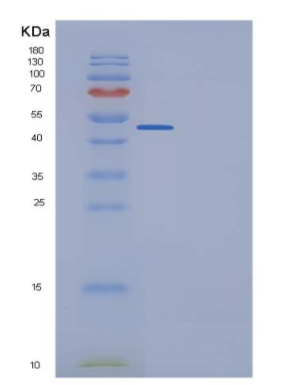 Recombinant Human Ephrin-B1 / EFNB1 Protein (His & Fc tag),Recombinant Human Ephrin-B1 / EFNB1 Protein (His & Fc tag)