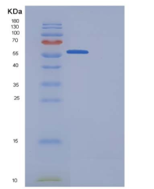 Recombinant Human Granulin / GRN / Progranulin Protein (His tag),Recombinant Human Granulin / GRN / Progranulin Protein (His tag)