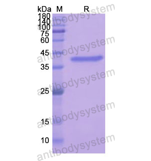 重组ANXA2蛋白,Recombinant Human ANXA2, N-His