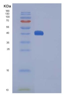 Recombinant Mouse CTLA4 / CD152 Protein (Fc tag),Recombinant Mouse CTLA4 / CD152 Protein (Fc tag)