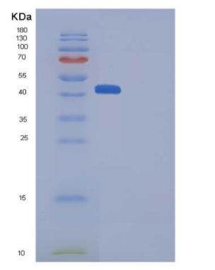 Recombinant Human HVEM / TNFRSF14 Protein (His & Fc tag),Recombinant Human HVEM / TNFRSF14 Protein (His & Fc tag)