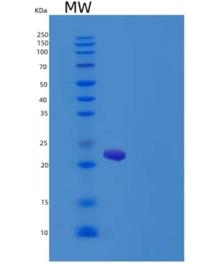 Recombinant Rat IL6 / Interleukin-6 Protein,Recombinant Rat IL6 / Interleukin-6 Protein