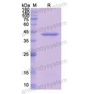 重组C8B蛋白,Recombinant Human C8B, N-His