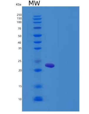 Recombinant Rat IGFBP6 / IBP6 Protein (His Tag),Recombinant Rat IGFBP6 / IBP6 Protein (His Tag)