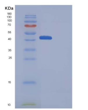 Recombinant Mouse CD70 / CD27L / TNFSF7 Protein (Fc Tag),Recombinant Mouse CD70 / CD27L / TNFSF7 Protein (Fc Tag)