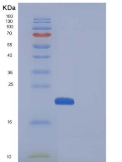 Recombinant Mouse CDNF / ARMETL1 Protein (His tag),Recombinant Mouse CDNF / ARMETL1 Protein (His tag)