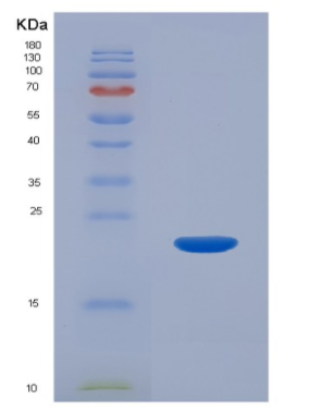 Recombinant Interleukin 1 Beta (IL1b),Recombinant Interleukin 1 Beta (IL1b)