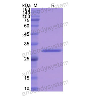 重組TUBB/Tubulin beta蛋白,Recombinant Human TUBB/Tubulin beta, N-His