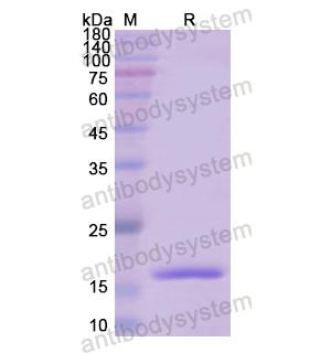 重组IVL蛋白,Recombinant Human IVL, N-His