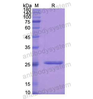 重組PRSS1蛋白,Recombinant Human PRSS1, N-His