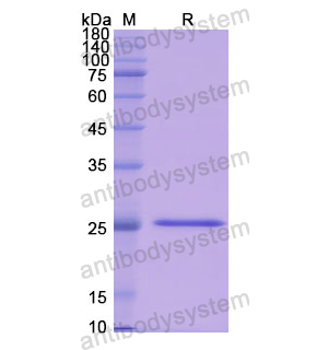 重組PRSS2蛋白,Recombinant Human PRSS2, N-His