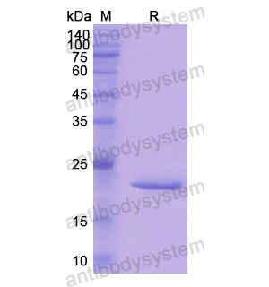 重組CTSL蛋白,Recombinant Human CTSL, N-His