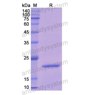 重組APRT蛋白,Recombinant Human APRT, N-His