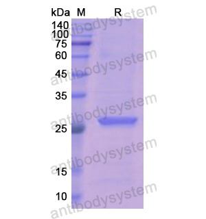 重組LAMB1 Protein蛋白,Recombinant Human LAMB1 Protein, N-His