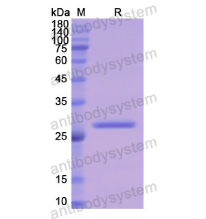 重組LYN蛋白,Recombinant Human LYN, N-His