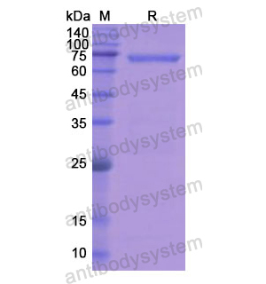 重组RET蛋白,Recombinant Human RET, N-His